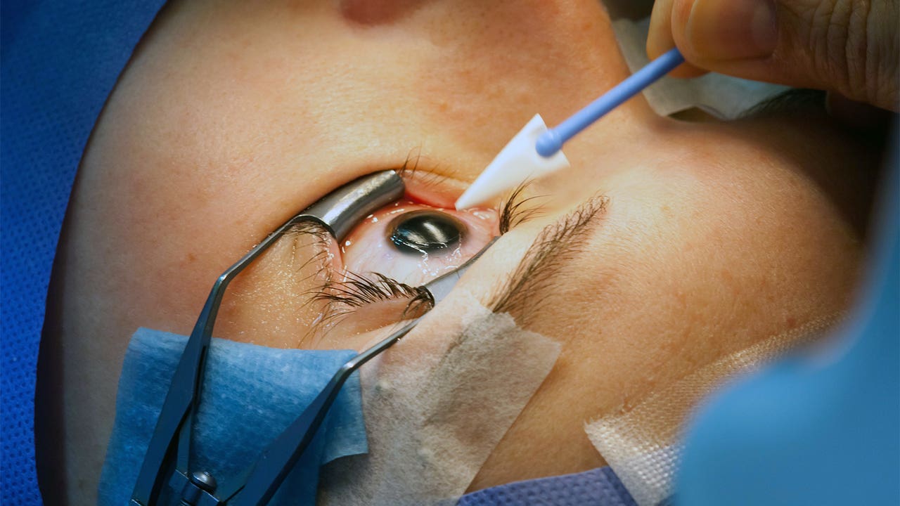 Nystagmus